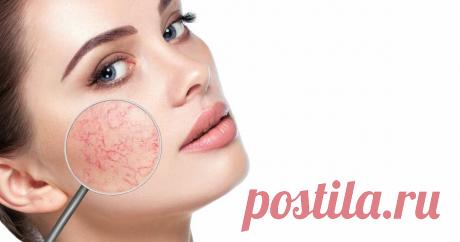 Лучшее средство от купероза для вас | СЕКРЕТЫ КРАСОТЫ | Яндекс Дзен