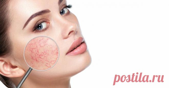 Лучшее средство от купероза для вас | СЕКРЕТЫ КРАСОТЫ | Яндекс Дзен