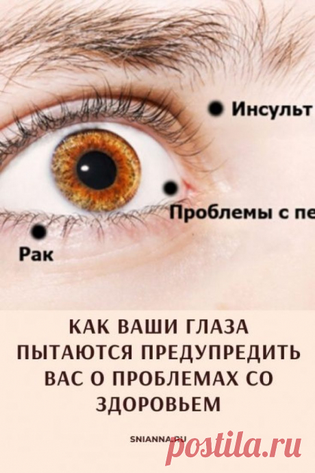 Диагностика по глазам. 8 признаков, посредством которых Ваши глаза предупреждают о проблемах со здоровьем Кликайте на фото, чтобы прочитать полностью ⤴
