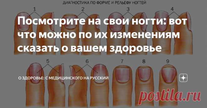 Посмотрите на свои ногти: вот что можно по их изменениям сказать о вашем здоровье Статья автора «О здоровье: с медицинского на русский » в Дзене ✍: Ногти являются придатками кожи и их патологические изменения и болезни могут быть симптомом многих заболеваний организма.