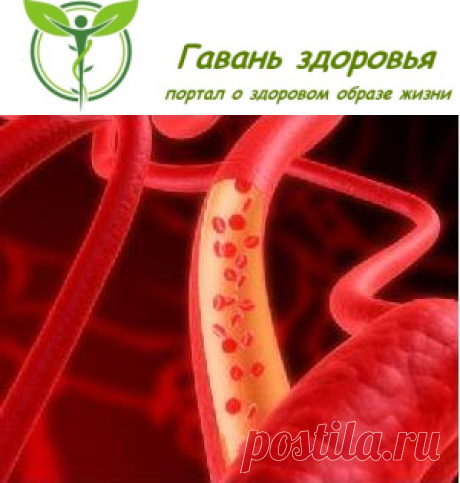 Как очистить сосуды? | Гавань здоровья