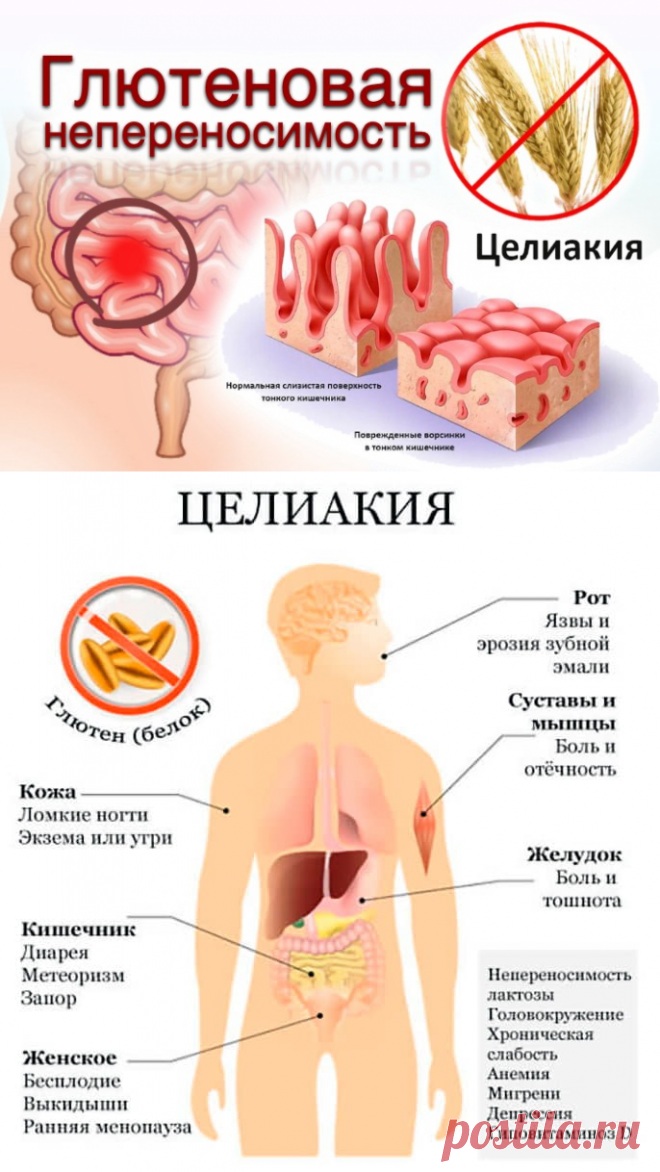 Целиакия - Доктор Натуропатии Хаим Лейбиман