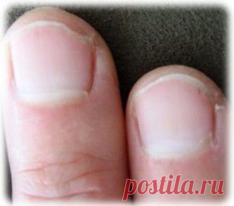 Маски для укрепления ногтей