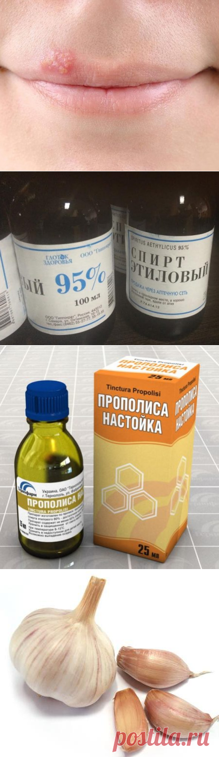 Лечение герпеса: 11 самых эффективных народных методов