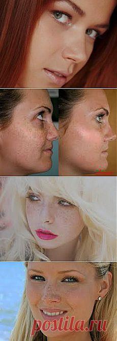 Как избавиться от веснушек быстро.