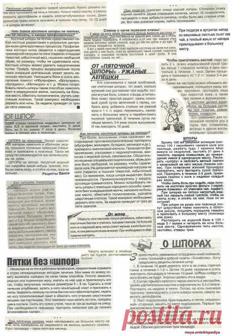 Отложение солей. Подагра. Шпоры.