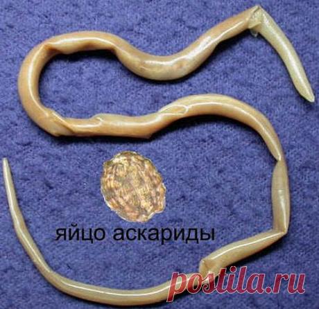 Очищение организма от паразитов
Очищение организма от паразитов народными средствами в домашних условиях. меры профилактики глистных инвазий (гельминтных заболеваний)