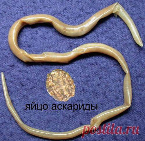 Очищение организма от паразитов
Очищение организма от паразитов народными средствами в домашних условиях. меры профилактики глистных инвазий (гельминтных заболеваний)