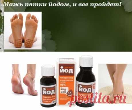 МАЖЬ ПЯТКИ ЙОДОМ И ВСЕ ПРОЙДЁТ!!!
Мой отец рассказывал, что, когда он служил в армии, у их врача была поговорка: «Мажьте пятки йодом, и все пройдет!» Эта фраза звучала для солдат как рецепт от стресса, раздражительности, переживаний, депрессии.
В детстве я не очень-то хорошо понимала смысл данной поговорки. «Какая связь между плохим настроением и пятками?» - спрашивала я отца, но он не мог мне толком ничего объяснить.