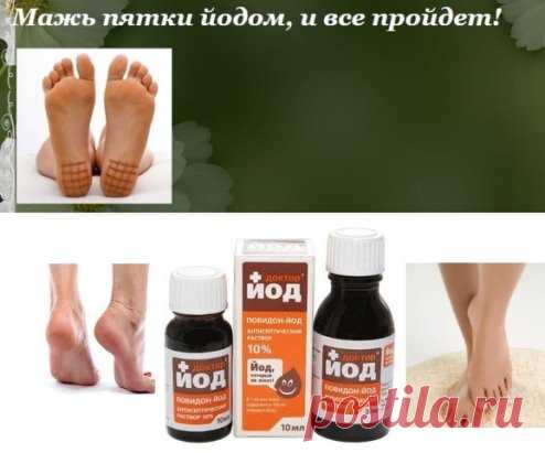 МАЖЬ ПЯТКИ ЙОДОМ И ВСЕ ПРОЙДЁТ!!!
Мой отец рассказывал, что, когда он служил в армии, у их врача была поговорка: «Мажьте пятки йодом, и все пройдет!» Эта фраза звучала для солдат как рецепт от стресса, раздражительности, переживаний, депрессии.
В детстве я не очень-то хорошо понимала смысл данной поговорки. «Какая связь между плохим настроением и пятками?» - спрашивала я отца, но он не мог мне толком ничего объяснить.
