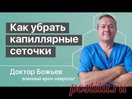 Как убрать капиллярные сеточки на ногах | Исцеляйся Сам и Доктор Божьев