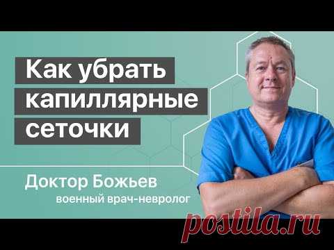 Как убрать капиллярные сеточки на ногах | Исцеляйся Сам и Доктор Божьев