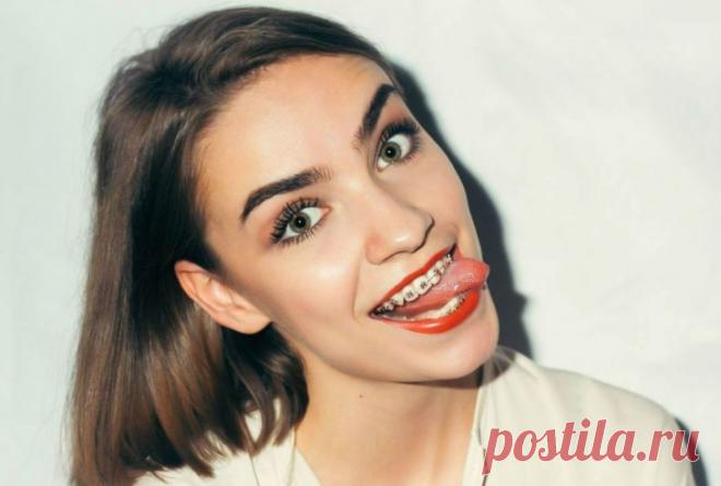 Брекеты - фото пациентов проходящих курс лечения и их результаты