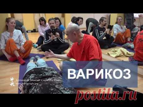 Варикозное расширение вен. Варикоз. Здоровье с Му Юйчунем.