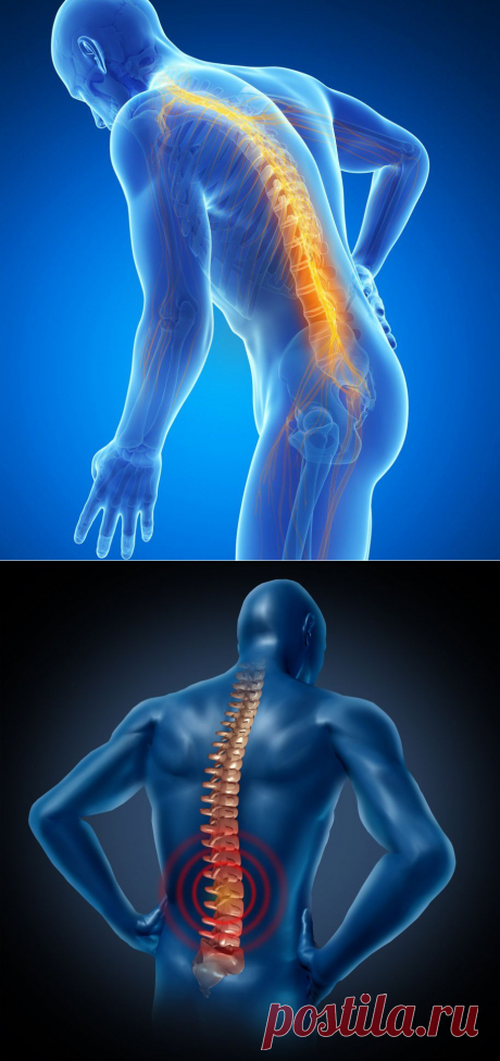 Сколиоз: неочевидные причины