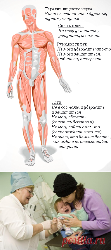 Рассеянный склероз: fillum