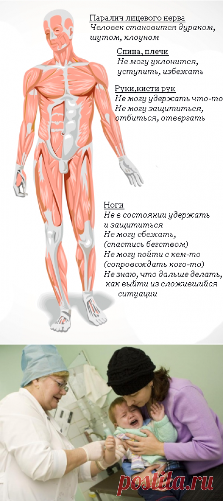 Рассеянный склероз: fillum