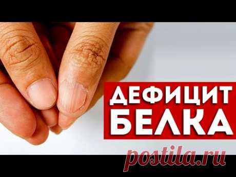 7 признаков дефицита белка, которые нельзя игнорировать