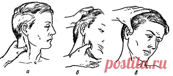 Точки прижатия артерий головы для остановки кровотечения.