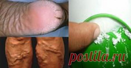 Настоящее чудо. Убирает трещины на пятках, натоптыши и мозоли всего за 10 дней