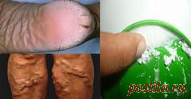 Настоящее чудо. Убирает трещины на пятках, натоптыши и мозоли всего за 10 дней