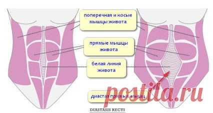 ДИАСТАЗ ПРЯМЫХ МЫШЦ ЖИВОТА 
Прежде всего проверьте, нет ли расхождения мышц живота (диастаза), мышц, которые проходят сверху вниз от грудной клетки к лобковой кости. Соединительная ткань между этими мышцами может отреагировать на напряжение во время беременности без боли и кровотечения, подобно застежке-молнии, которая раскрывается под нажимом. Такое расхождение предохраняет мышцы от чрезмерного напряжения. Это нормально, однако >>>