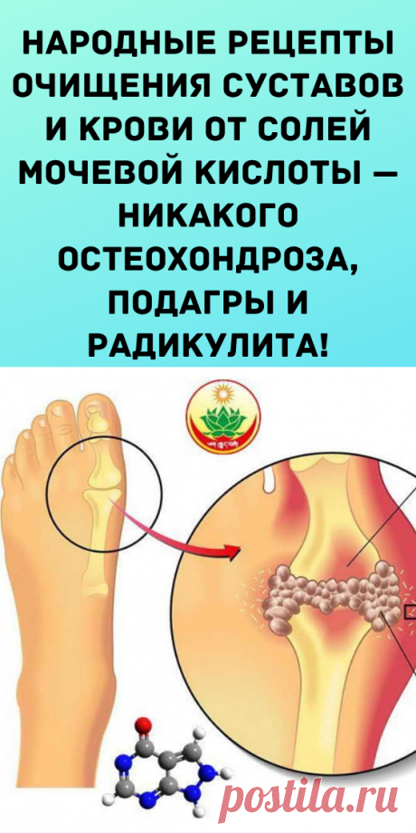 Народные рецепты очищения суставов и крови от солей мочевой кислоты — никакого остеохондроза, подагры и радикулита!