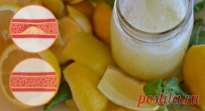 Топ 20 преимуществ употребления лимонной воды по утрам - Журнал для женщин Невероятно полезно! Знаменитости, такие как Хилари Дафф, Жизель Бундхен, Дженнифер Энистон и Кристи Бринкли, любят лимонную воду в разных формах — холодную, теплую и горячую. Эти отчеты сделали лимонную воду одним из самых популярных напитков во всем мире. Этот напиток имеет довольно долгую историю. На протяжении многих лет он оставался классическим, будь то желание получить […]