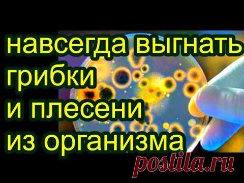 избавиться от грибов и плесени  в теле, В чем причина ПСОРИАЗА ?