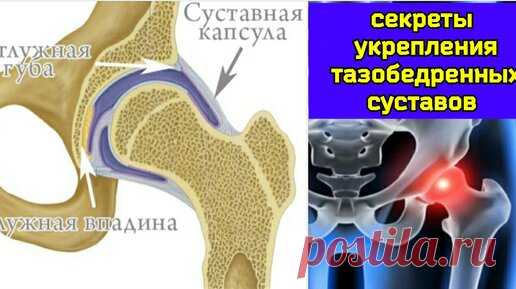 Истощение капсулы тазобедренного сустава не даёт жить ногам и мозгу. Упражнения для восстановления синовиального питания | Причины Здоровья | Дзен