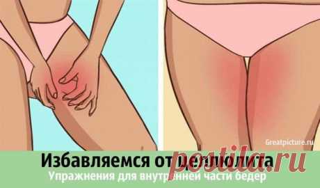 Новости - МирТесен
