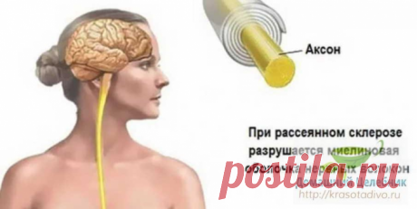 Народные средства для улучшения мозгового кровообращения: скажи «нет» слабоумию, рассеянности и немощи