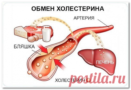Уровень холестерина можно снизить без проблем!