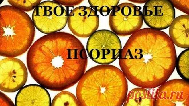 Лечение псориаза домашними средствами. Самые эффективные рецепты