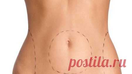 Липосакция в домашних условиях - Женский портал Брюнеточка