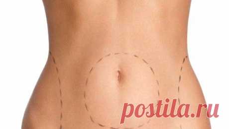 Липосакция в домашних условиях - Женский портал Брюнеточка