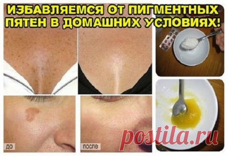 СУПЕР МАСКА ДЛЯ ЧИСТКИ ЛИЦА. Невероятный эффект! Девочки это просто находка! Всего через 15 минут лицо выглядит как в журнале
1. Умываем лицо привычным способом, закалываем волосы, чтобы лицо было открытым.
2. Готовим смесь №1. Берем столовую ложку пены для бритья, добавляем пол чайной ложки соды. Хорошенько мешаем.
3. Кипятим воду в кастрюле, бросаем горсть цветков сухой ромашки.
Ставим кастрюлю на стол, накрываемся полотенцем и парим лицо. Хватает минут 5-7.
4. На распаренное влажное лиц