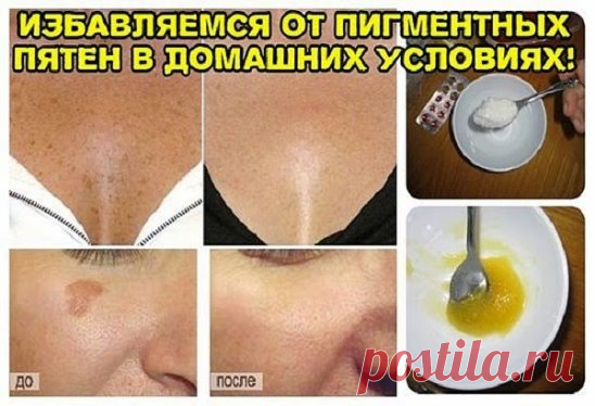 СУПЕР МАСКА ДЛЯ ЧИСТКИ ЛИЦА. Невероятный эффект! Девочки это просто находка! Всего через 15 минут лицо выглядит как в журнале
1. Умываем лицо привычным способом, закалываем волосы, чтобы лицо было открытым.
2. Готовим смесь №1. Берем столовую ложку пены для бритья, добавляем пол чайной ложки соды. Хорошенько мешаем.
3. Кипятим воду в кастрюле, бросаем горсть цветков сухой ромашки.
Ставим кастрюлю на стол, накрываемся полотенцем и парим лицо. Хватает минут 5-7.
4. На распаренное влажное лиц