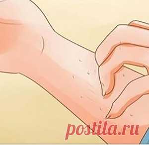 5 симптомов почечной недостаточности, которые вы скорее всего игнорируете - МирТесен