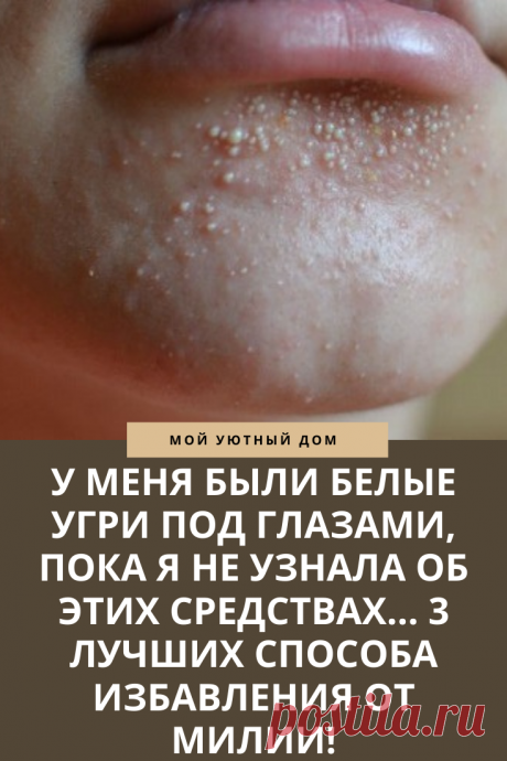 Способы как избавится от милии