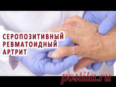 Что нужно знать о серопозитивном ревматоидном артрите
