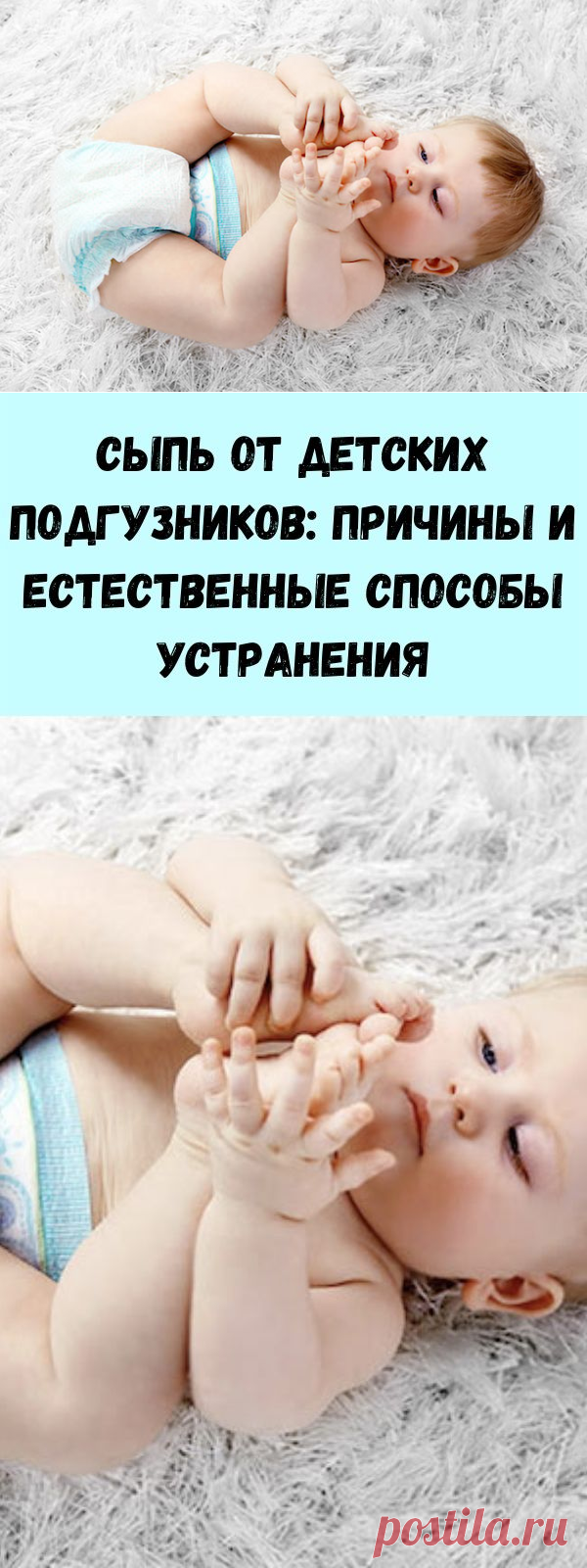 Сыпь от детских подгузников: причины и естественные способы устранения - Советы на каждый день