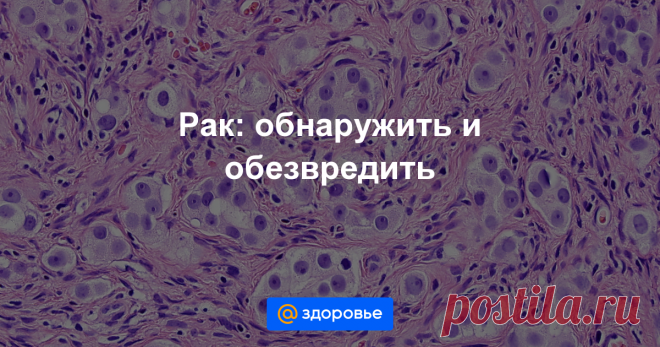 Все о раке Рассказываем, как предотвратить онкологическое заболевание, и что делать, если диагноз все же поставили