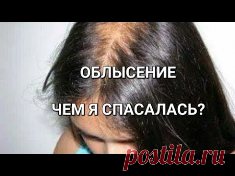 ВЫПАДЕНИЕ ВОЛОС у женщин