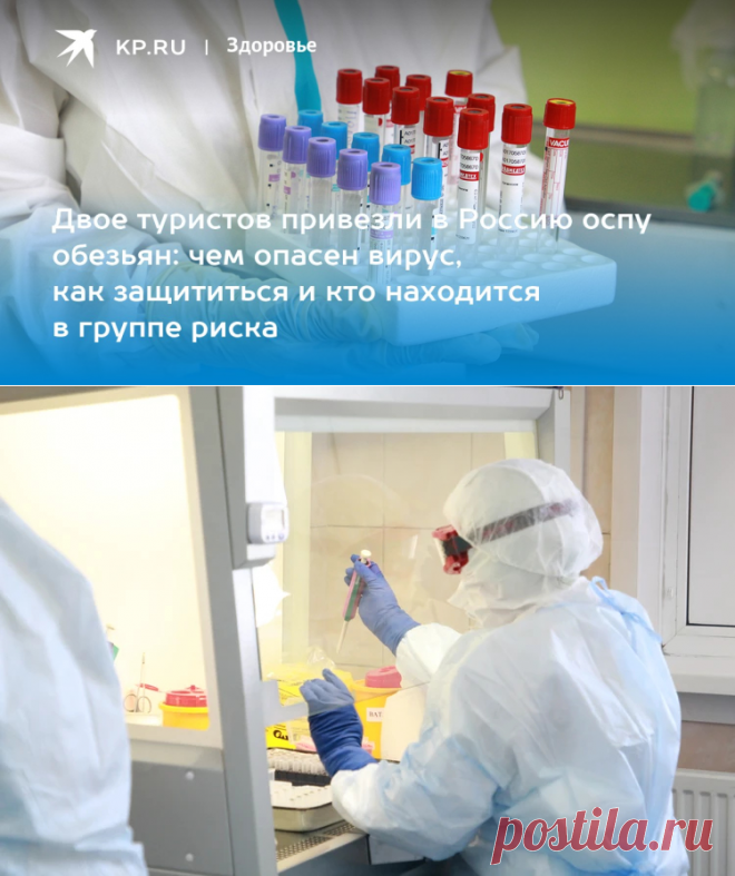 24-1-24--ОСПА ОБЕЗЬЯН: симптомы, лечение, диагностика - KP.RU