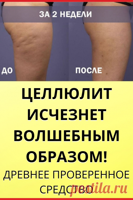 Целлюлит исчезнет волшебным образом!
Древнее проверенное средство. Целлюлит действительно исчезает всего лишь за 2 недели! Применяйте эти советы и вы будете неотразимы!