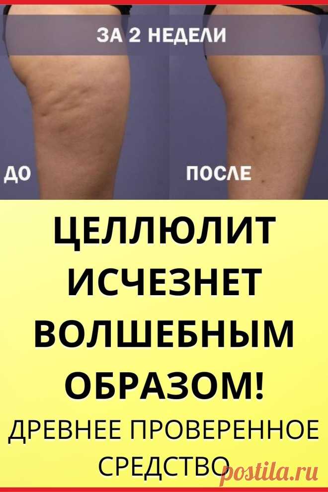 Целлюлит исчезнет волшебным образом!
Древнее проверенное средство. Целлюлит действительно исчезает всего лишь за 2 недели! Применяйте эти советы и вы будете неотразимы!