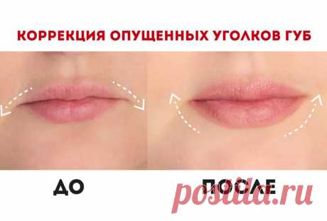 Поднимаем уголки губ. Все возможно с нашим видео! Молодость лица продлиться намного дольше!