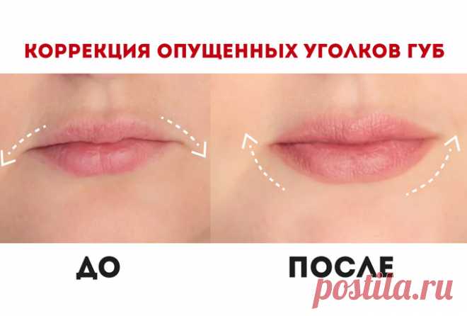 Поднимаем уголки губ. Все возможно с нашим видео! Молодость лица продлиться намного дольше!