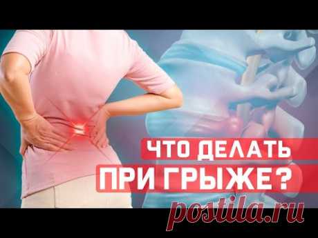 Какие упражнения нужно делать при межпозвонковой грыже?